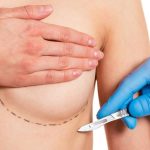 Prosedur Pada Payudara Untuk Melakukan Tindakan Pembesaran