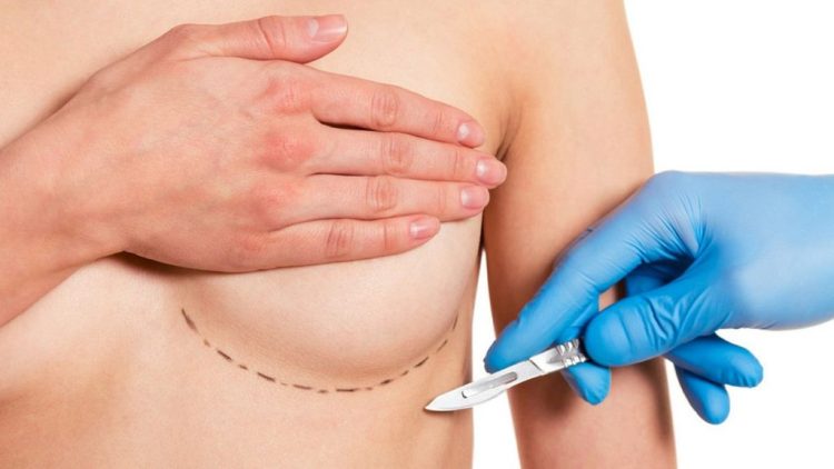 Prosedur Pada Payudara Untuk Melakukan Tindakan Pembesaran